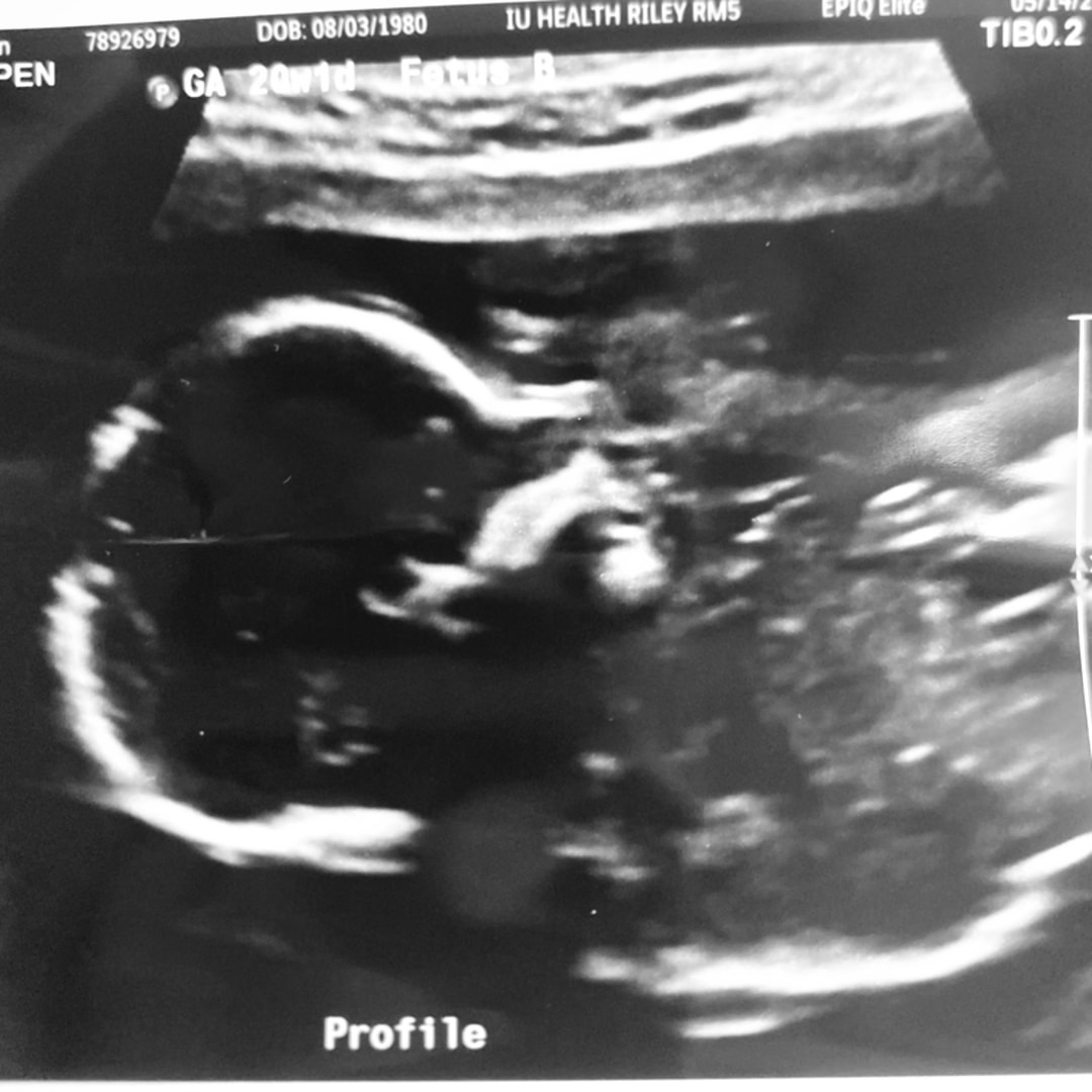 Photo shared by Autumn for their Babylist baby registry.