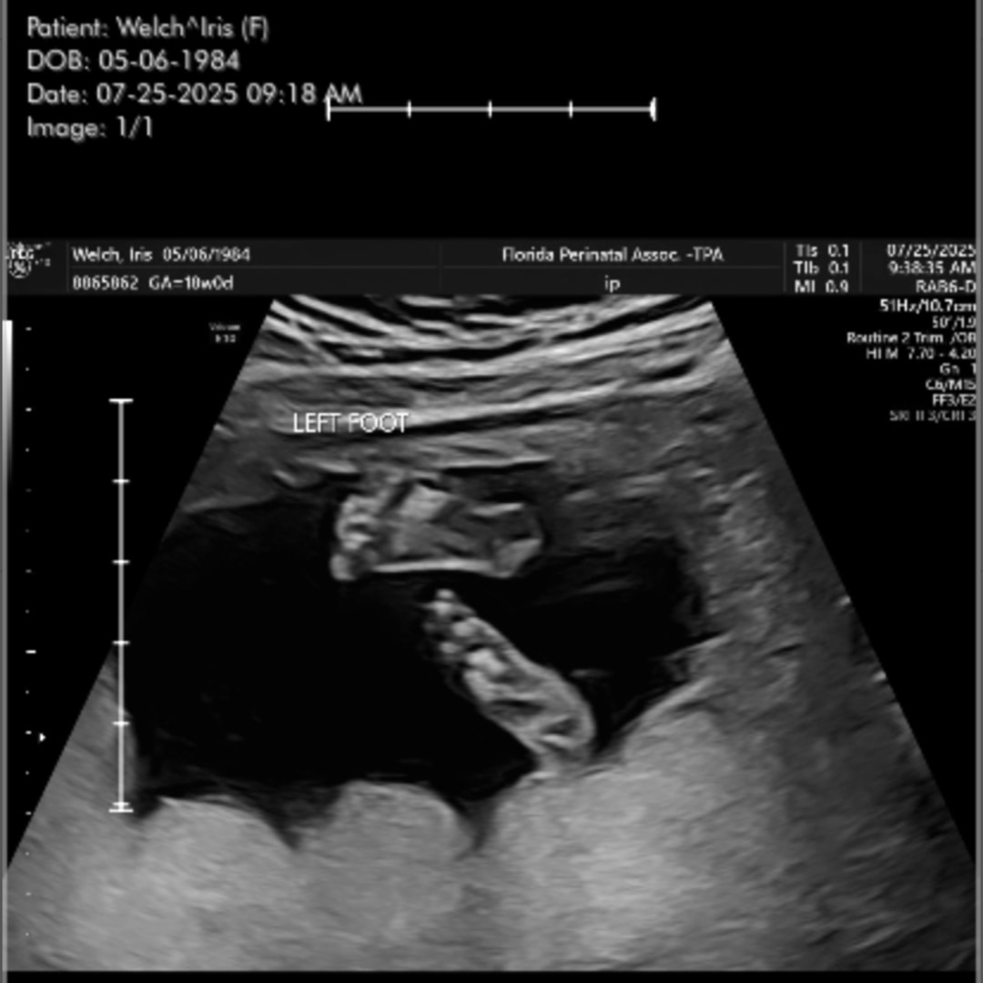 Photo shared by Iris for their Babylist baby registry.