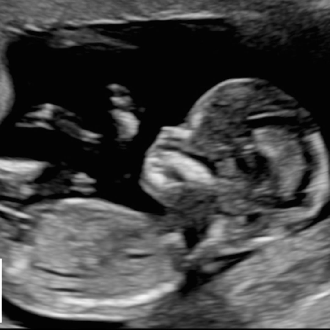 Photo shared by Ashley for their Babylist baby registry.