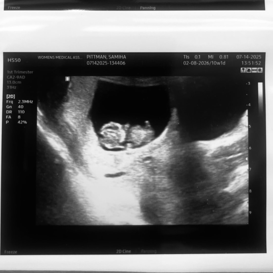 Photo shared by Samiha for their Babylist baby registry.