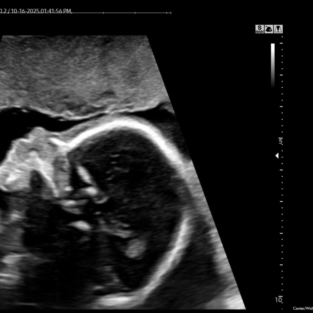 Photo shared by Maize for their Babylist baby registry.