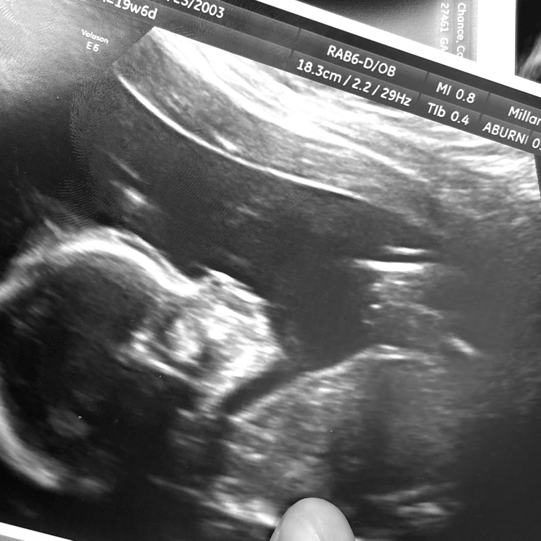 Photo shared by Carly for their Babylist baby registry.