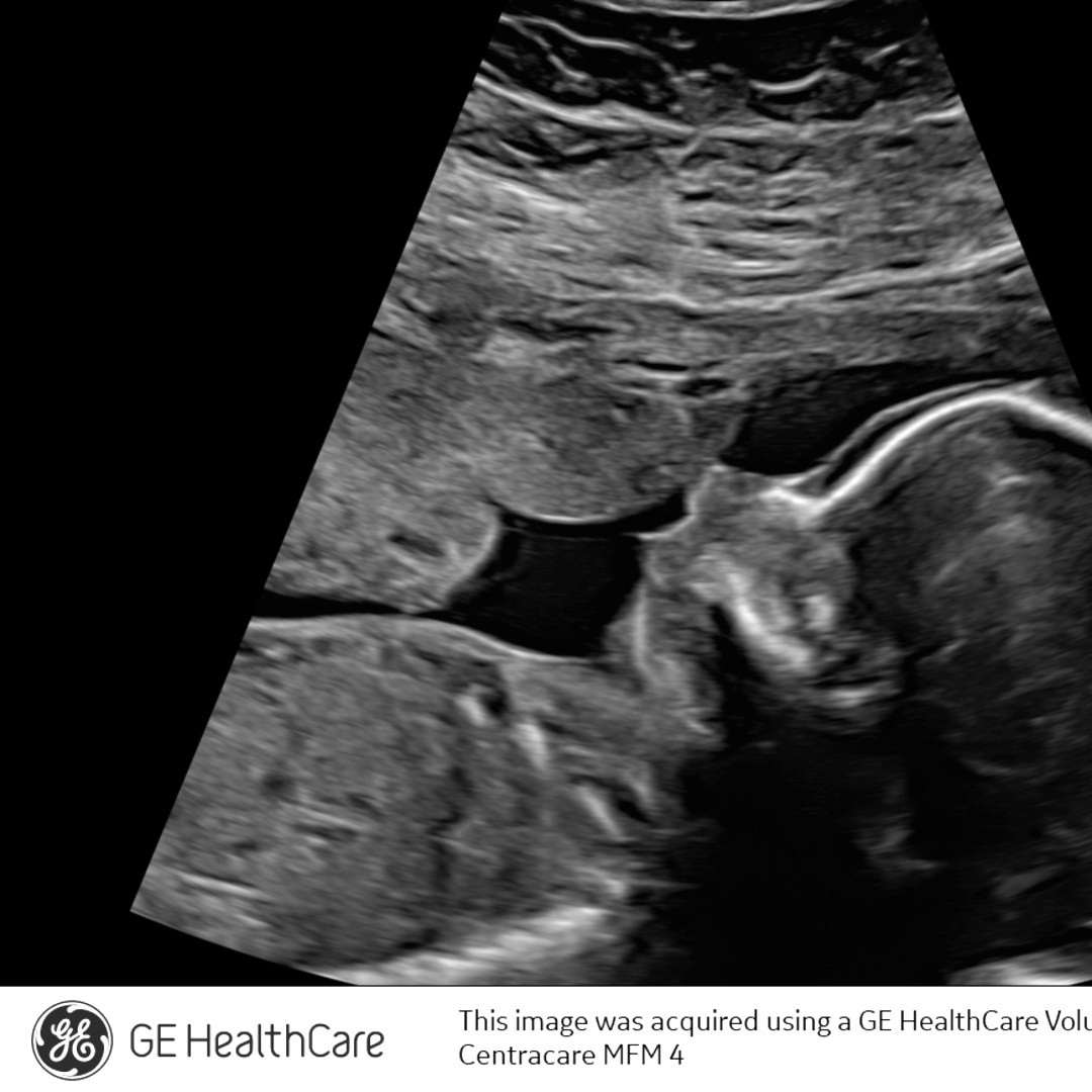 Photo shared by Dani for their Babylist baby registry.