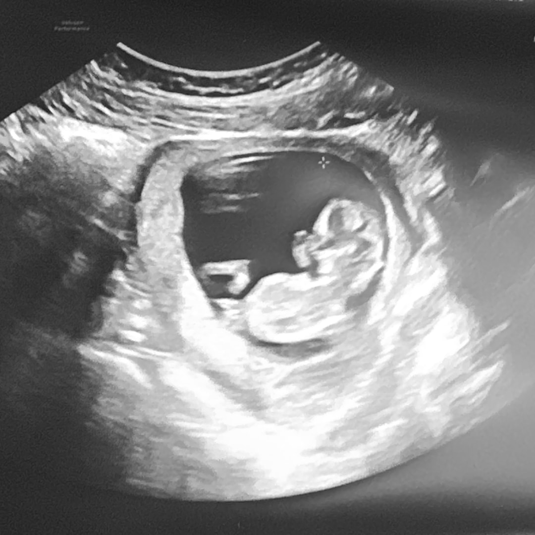 Photo shared by McKenna for their Babylist baby registry.