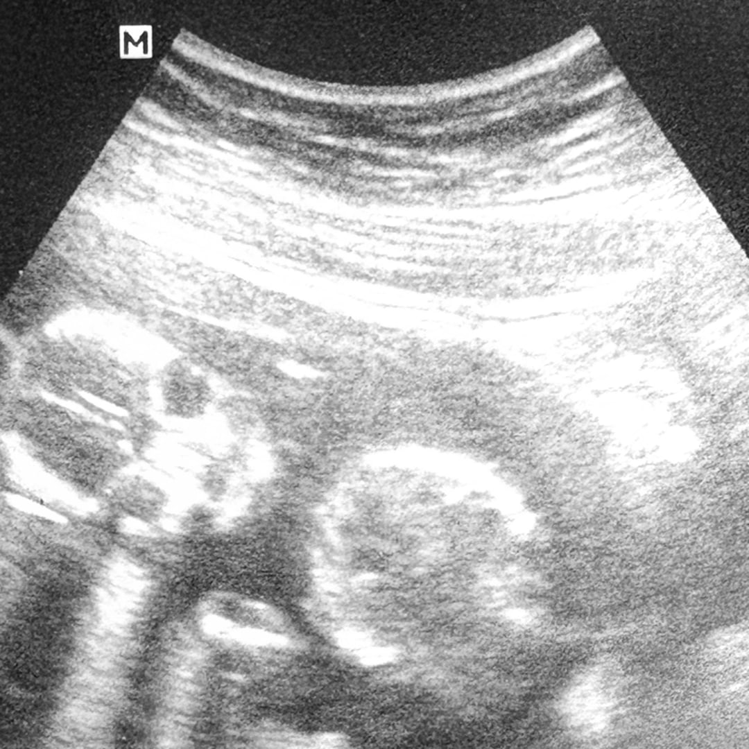 Photo shared by Jayden for their Babylist baby registry.