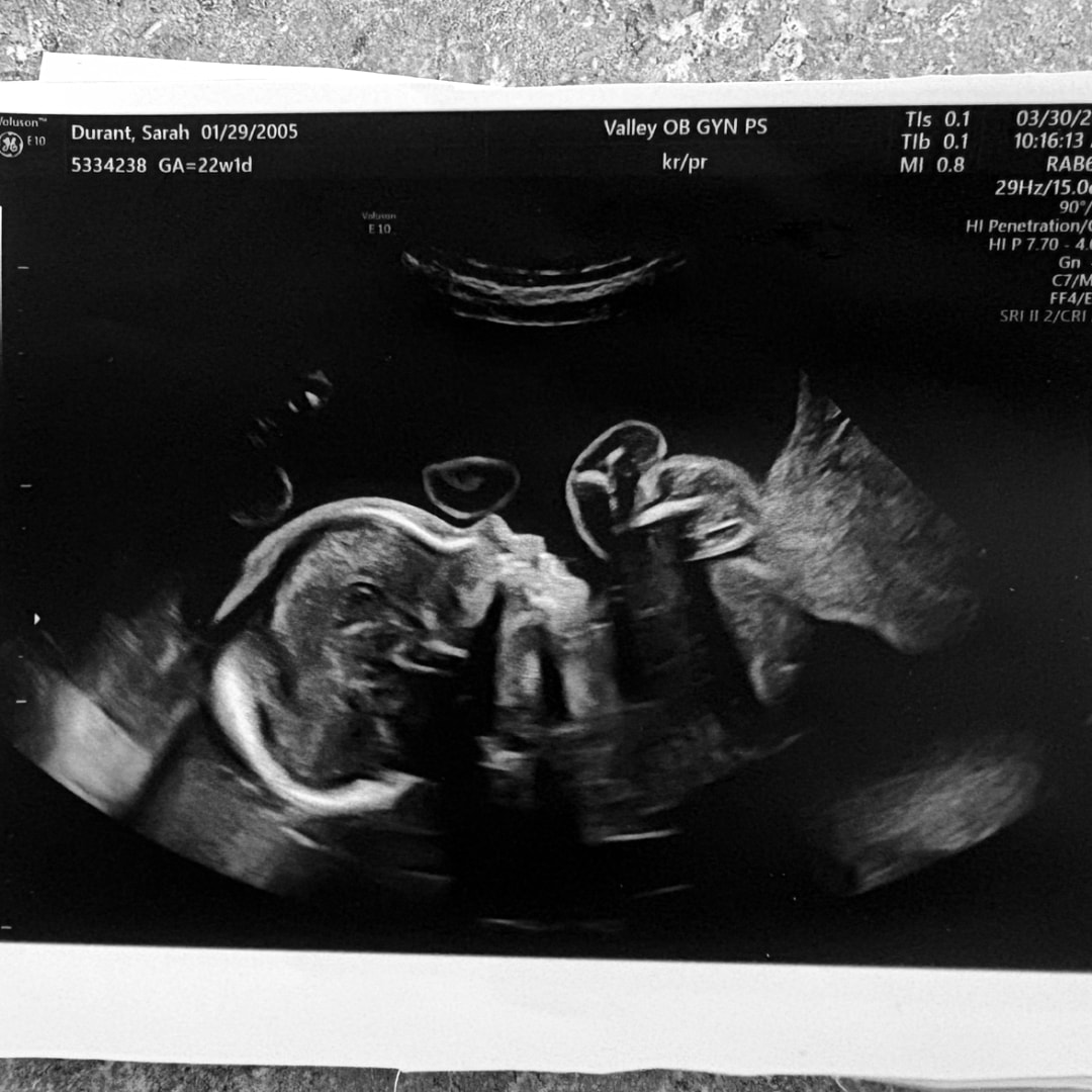 Photo shared by Sarah for their Babylist baby registry.