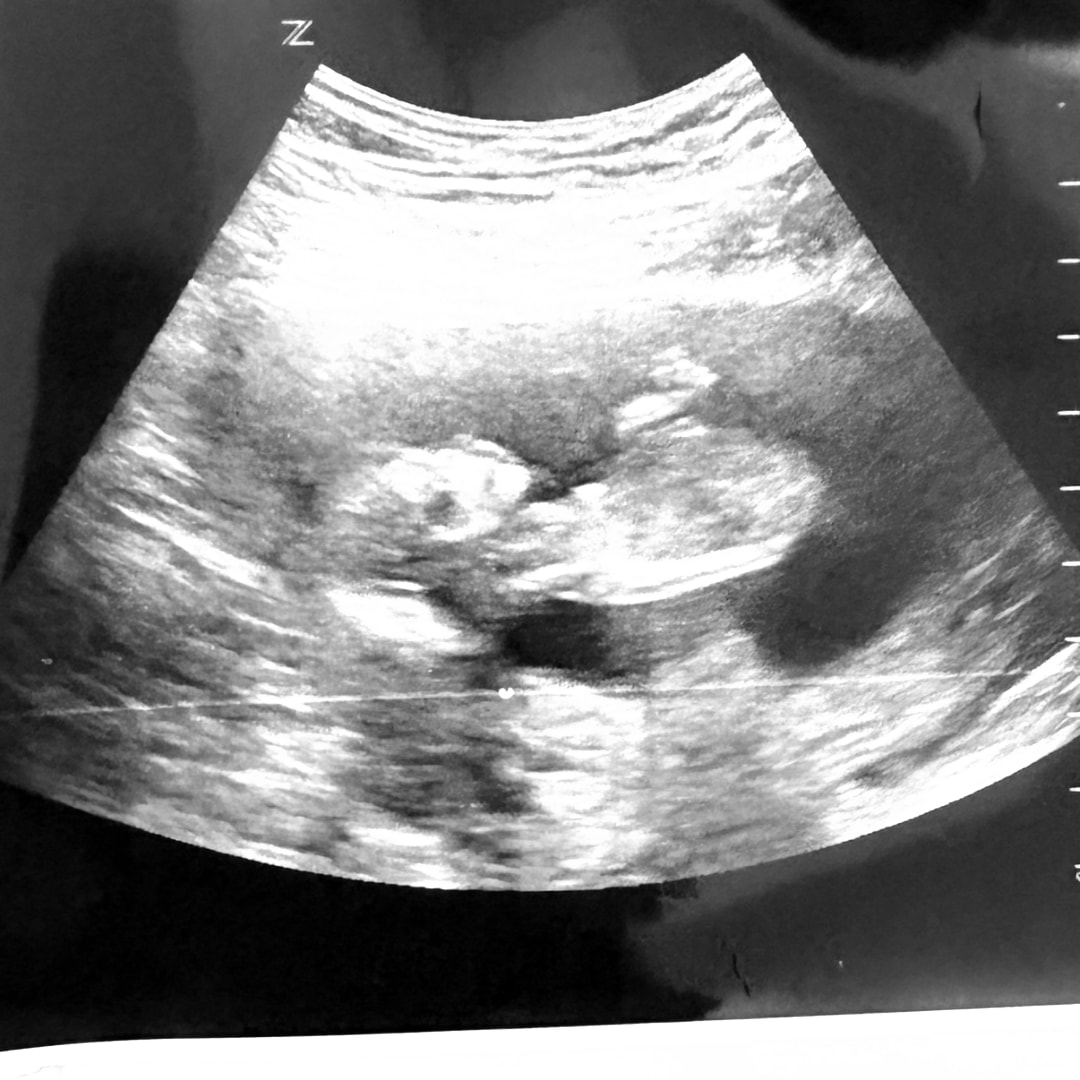 Photo shared by Lauren for their Babylist baby registry.