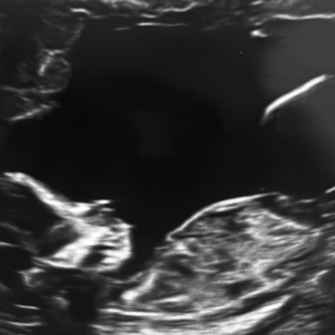 Photo shared by Baylee for their Babylist baby registry.