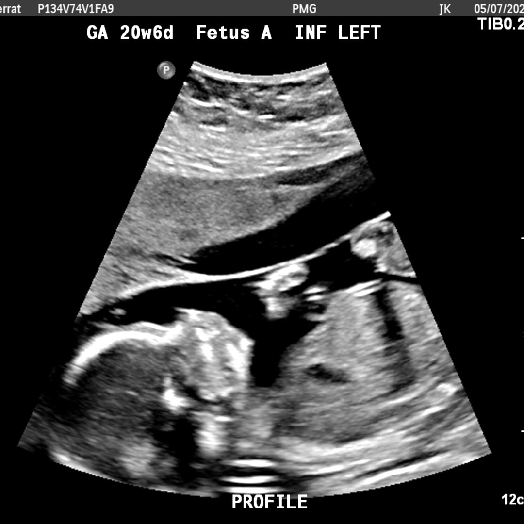 Photo shared by Montserrat for their Babylist baby registry.