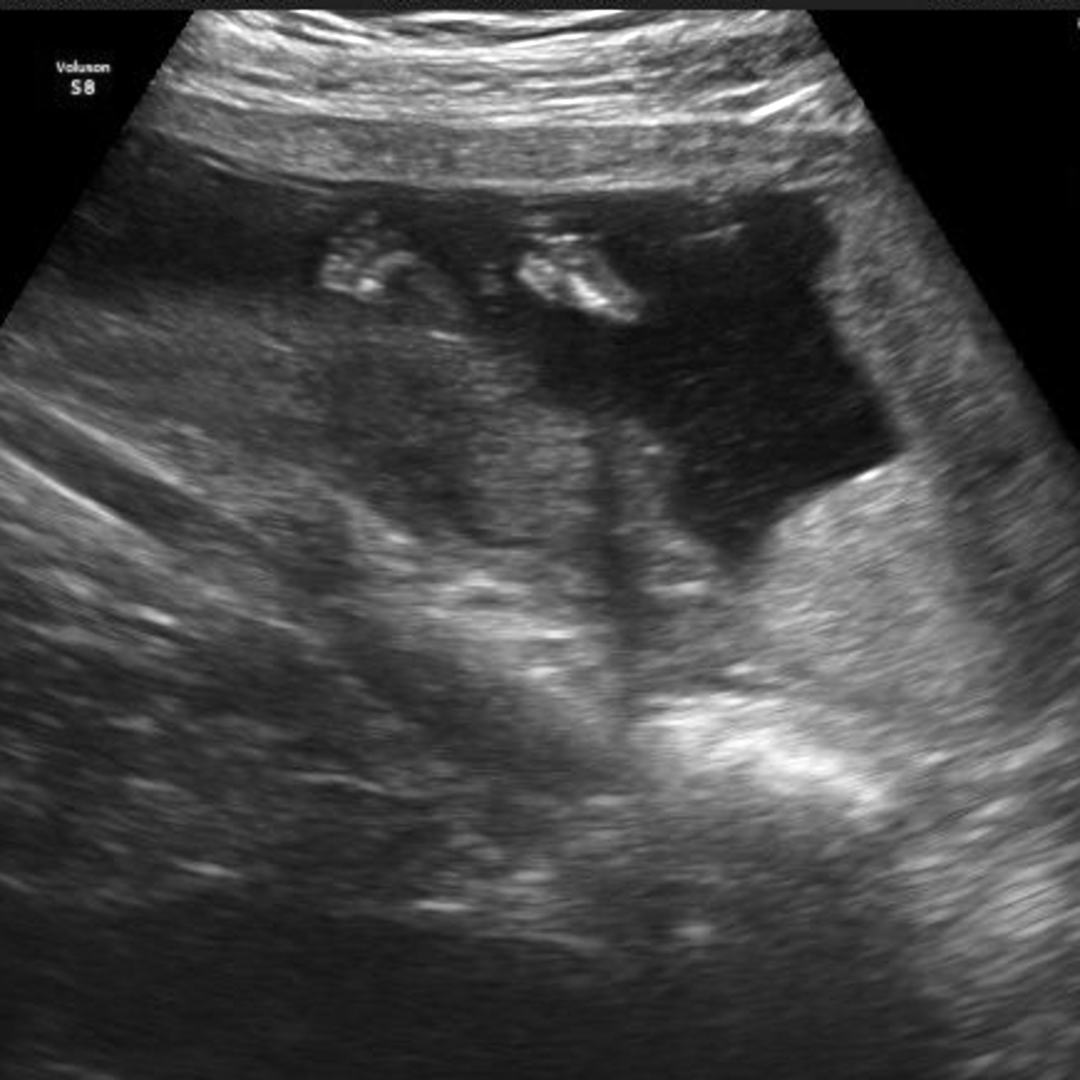 Photo shared by Alexis for their Babylist baby registry.