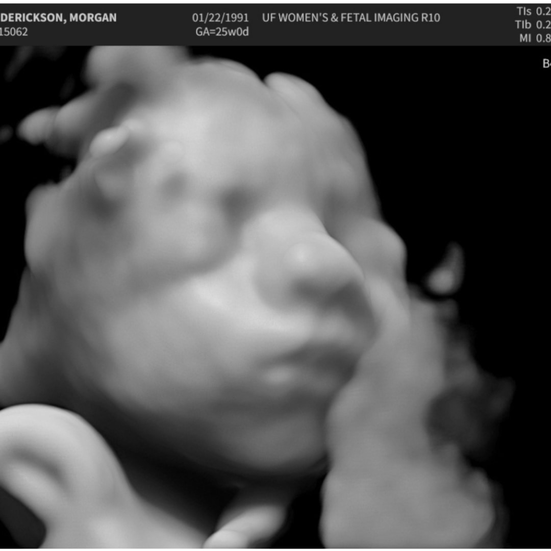 Photo shared by Morgan for their Babylist baby registry.