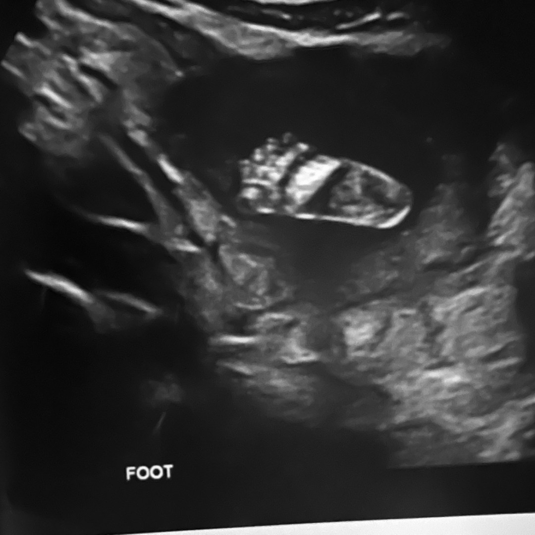Photo shared by Saniyah for their Babylist baby registry.