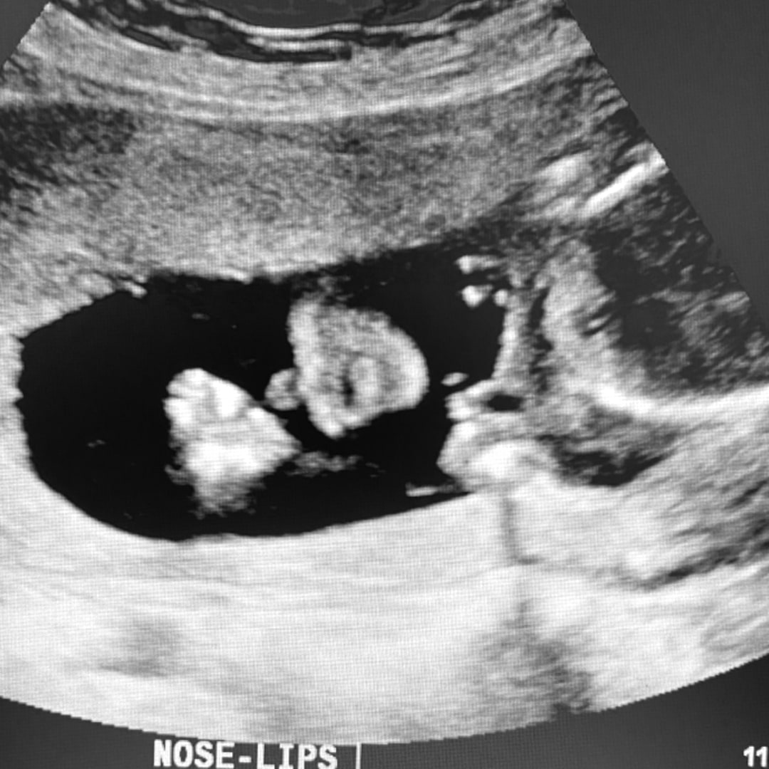 Photo shared by Amanda for their Babylist baby registry.