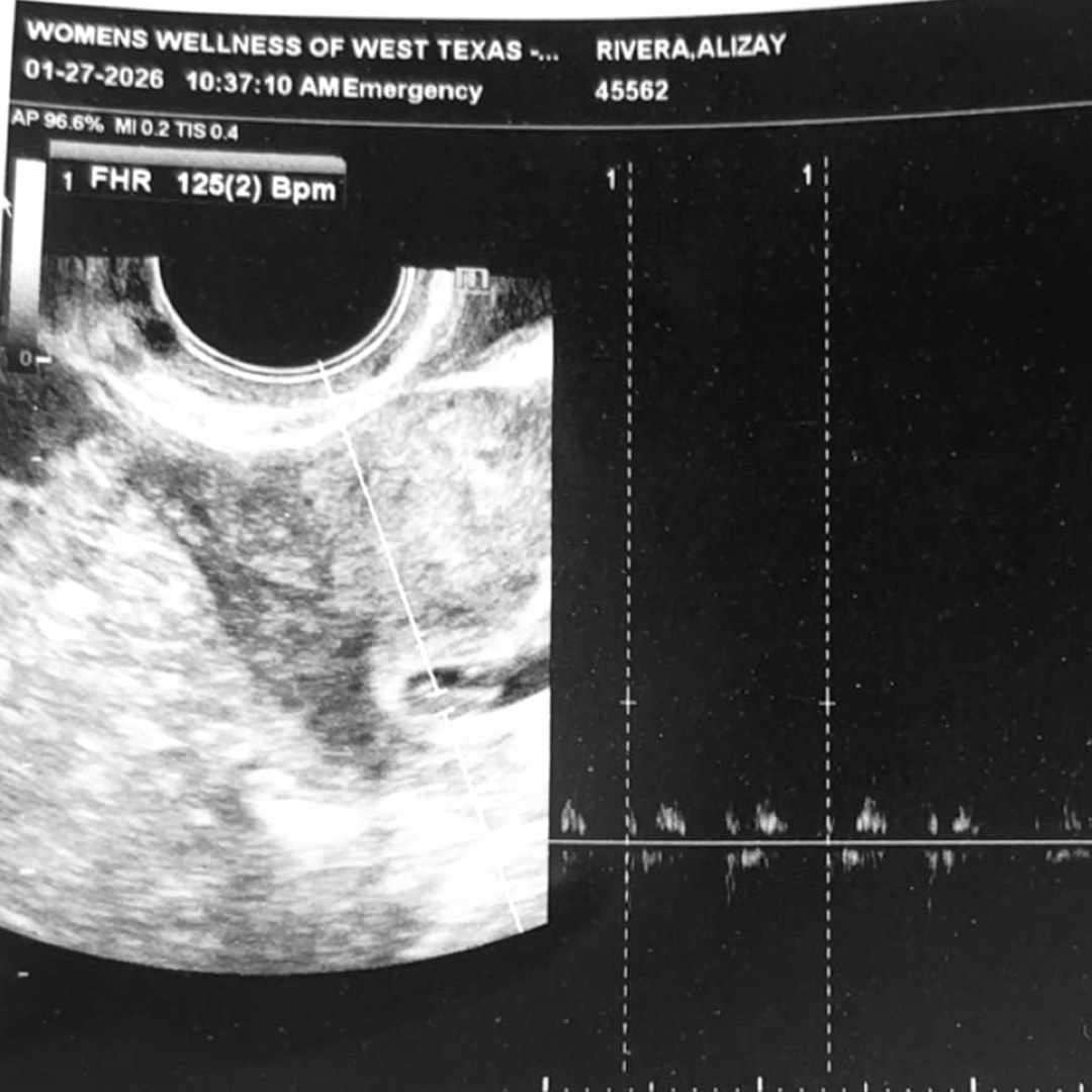 Photo shared by Alizay for their Babylist baby registry.