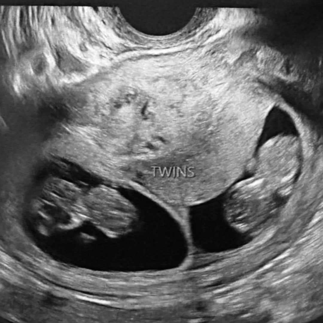 Photo shared by Rachel for their Babylist baby registry.