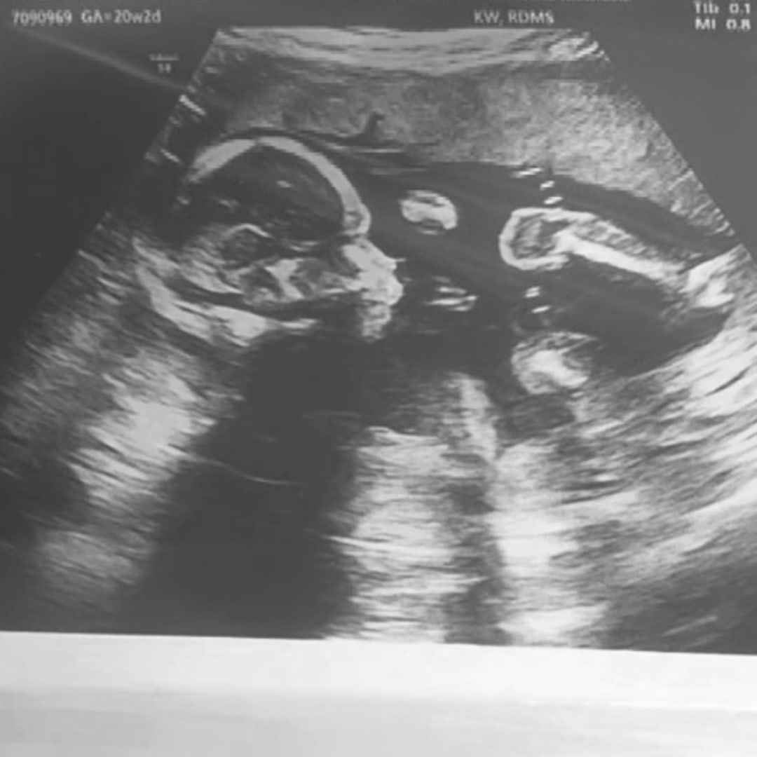 Photo shared by Vivian for their Babylist baby registry.