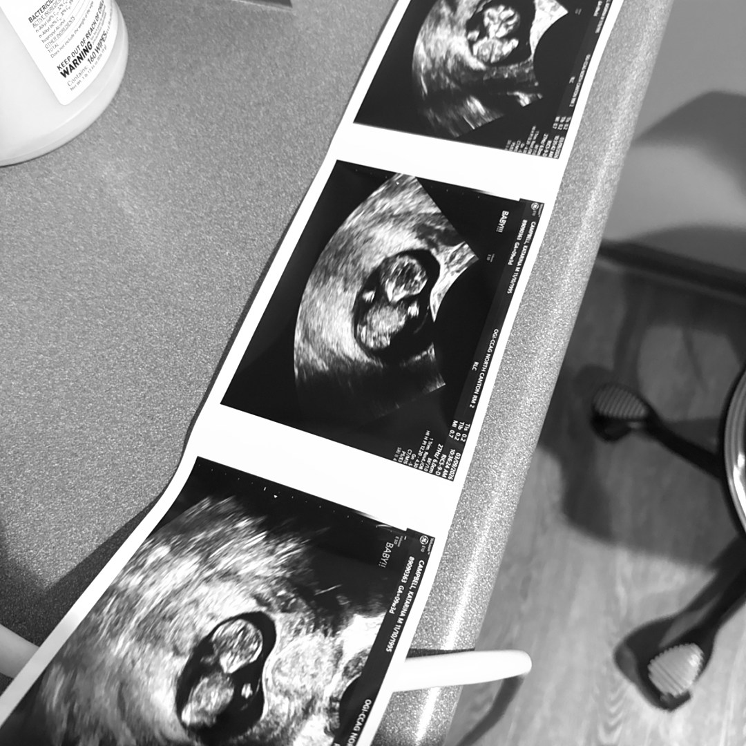 Photo shared by Katarina for their Babylist baby registry.