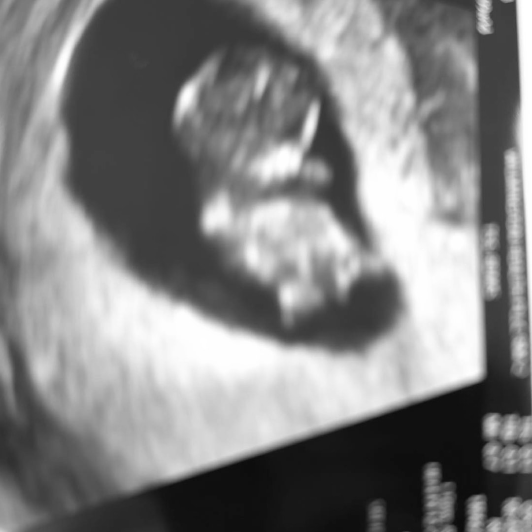 Photo shared by Amy and Auston for their Babylist baby registry.