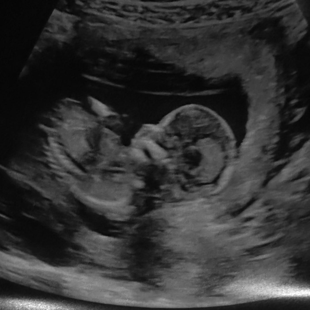 Photo shared by Cierra for their Babylist baby registry.