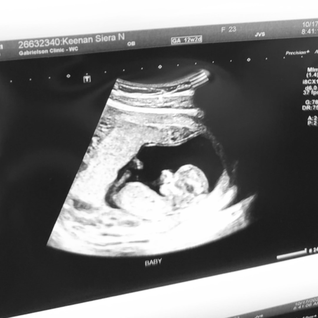 Photo shared by Siera for their Babylist baby registry.