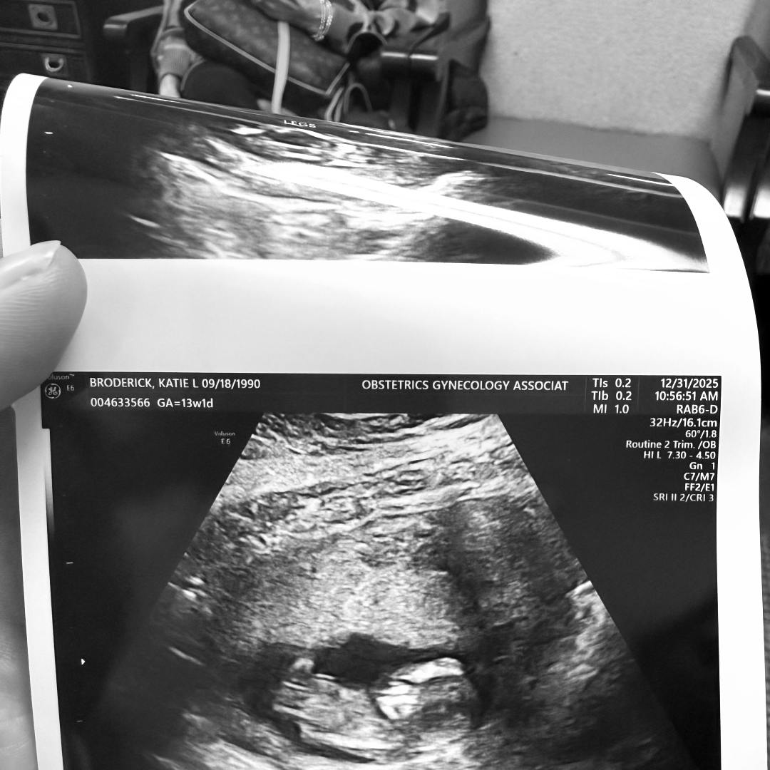 Photo shared by Katie for their Babylist baby registry.