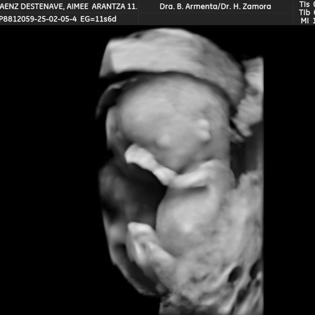 Photo shared by Arantza for their Babylist baby registry.