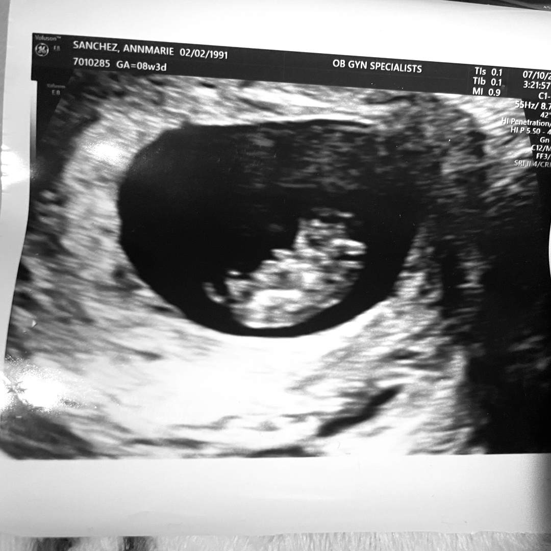 Photo shared by Annmarie for their Babylist baby registry.