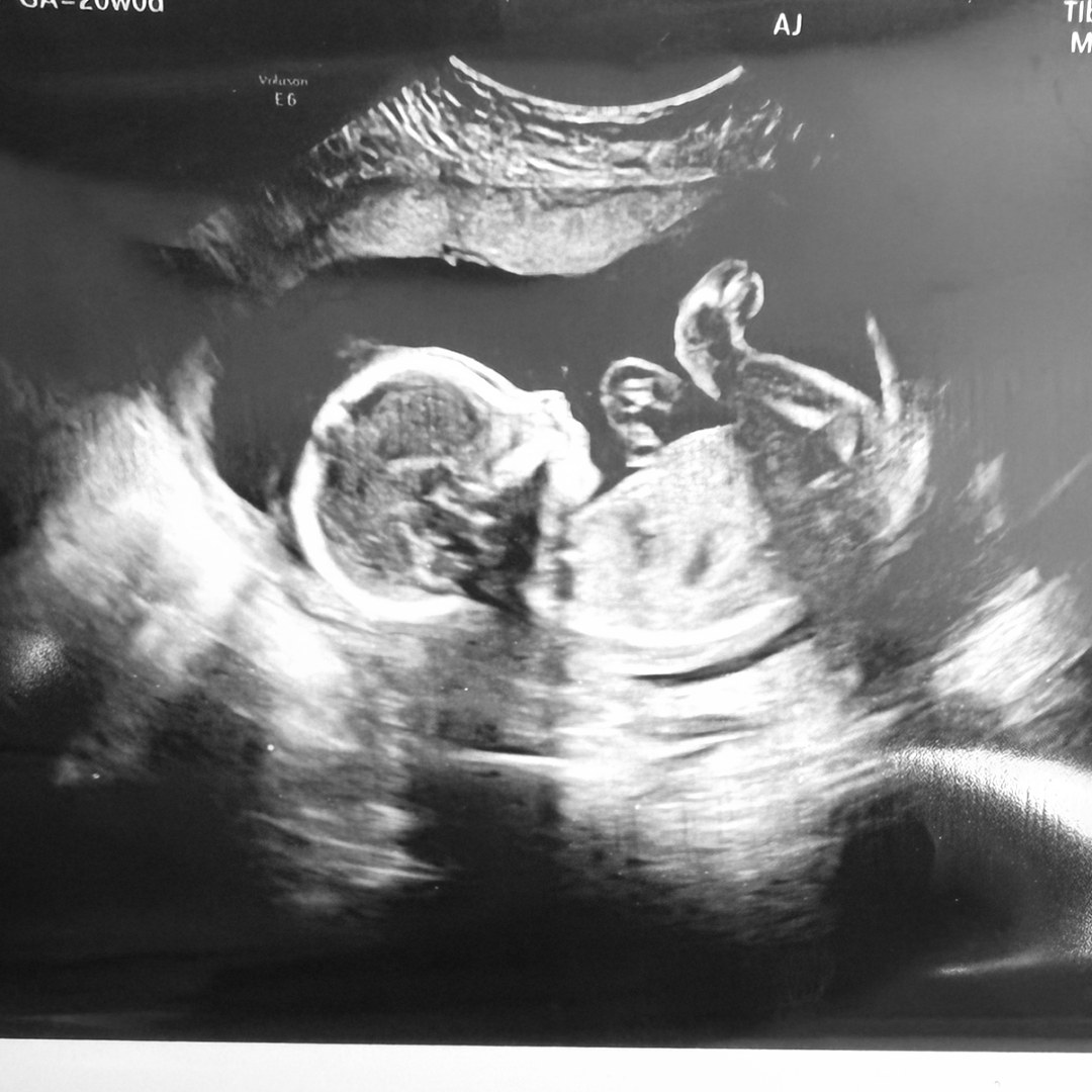 Photo shared by Hannah for their Babylist baby registry.