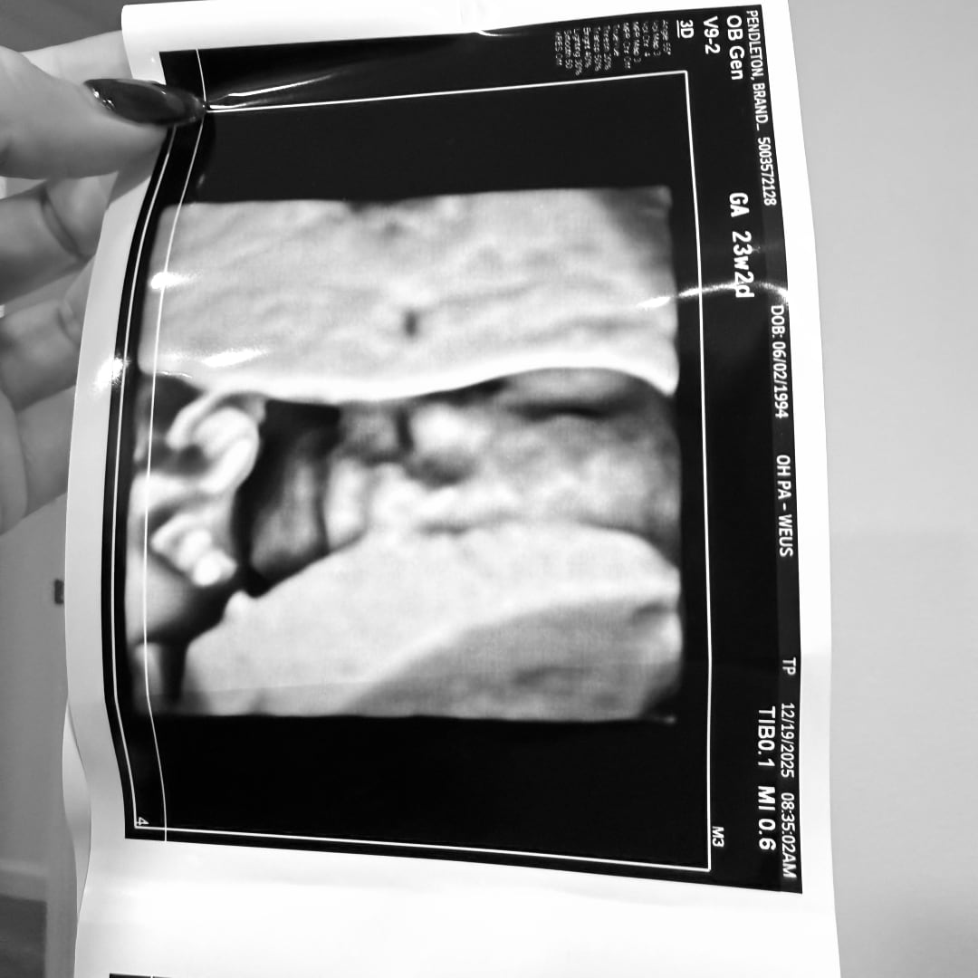 Photo shared by Brandee for their Babylist baby registry.