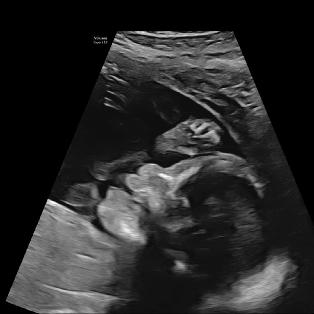 Photo shared by Gina for their Babylist baby registry.