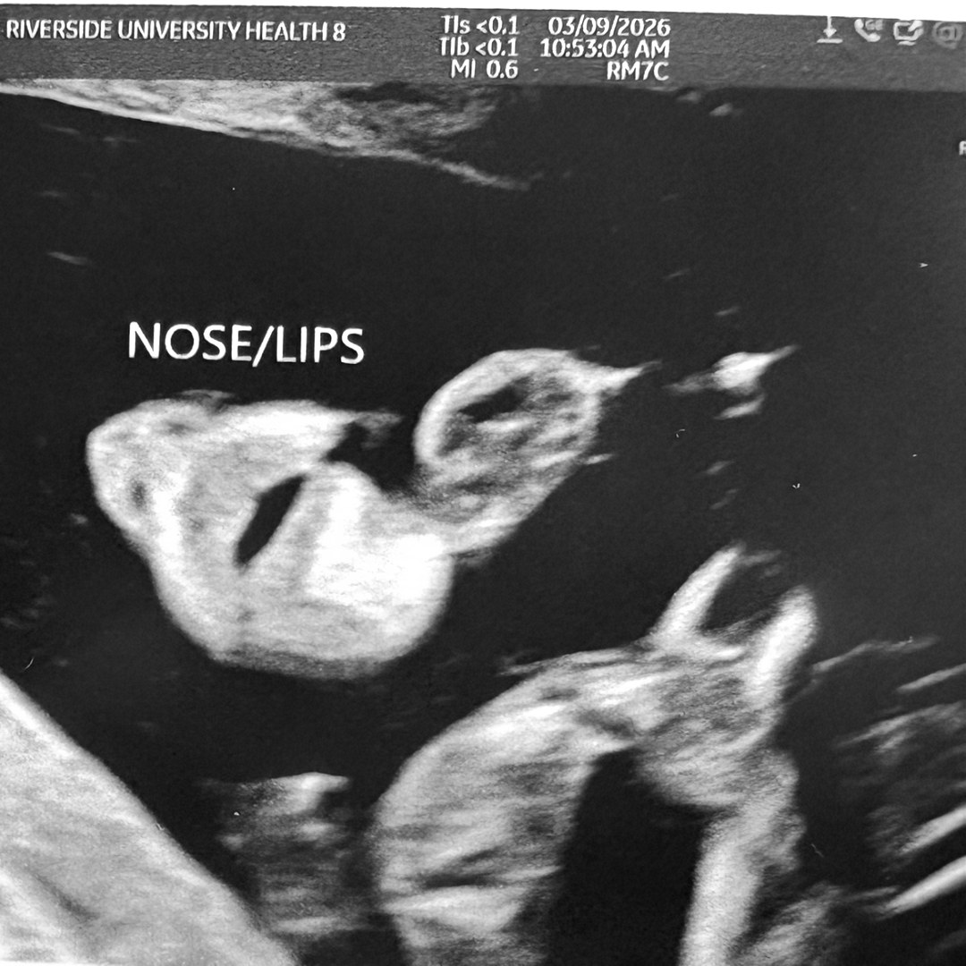 Photo shared by Christianna for their Babylist baby registry.