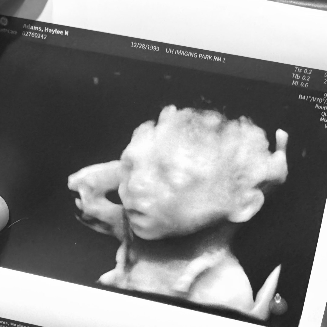 Photo shared by Haylee for their Babylist baby registry.