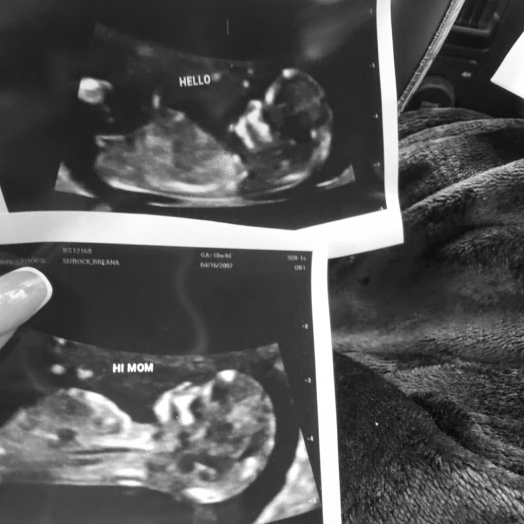 Photo shared by Breana for their Babylist baby registry.