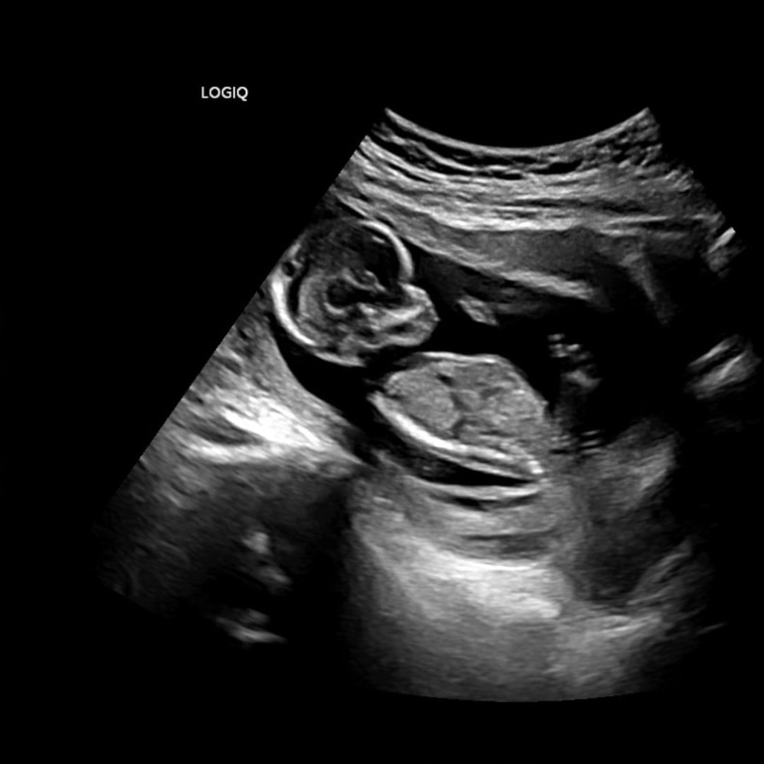 Photo shared by Marie for their Babylist baby registry.