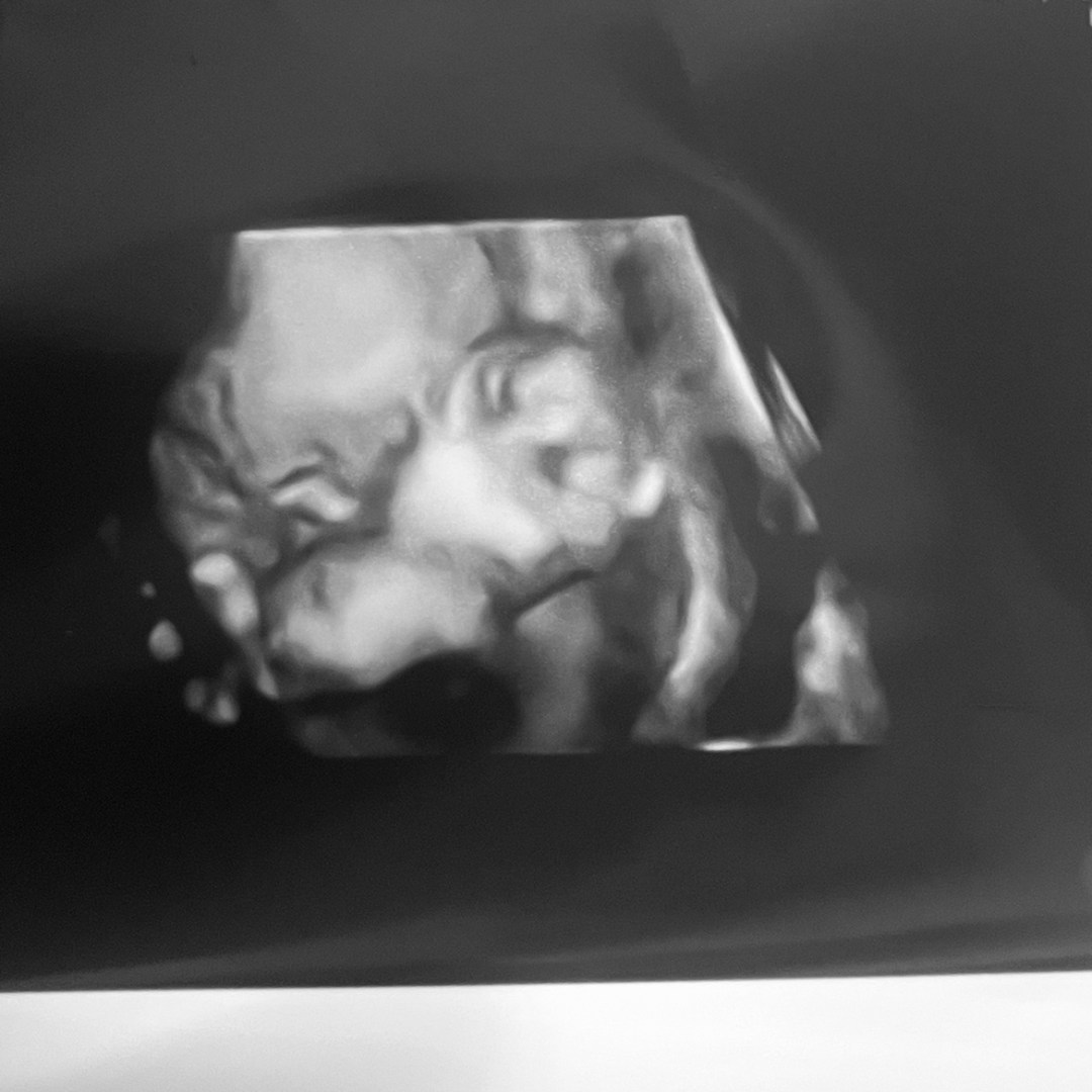 Photo shared by Gabriela for their Babylist baby registry.