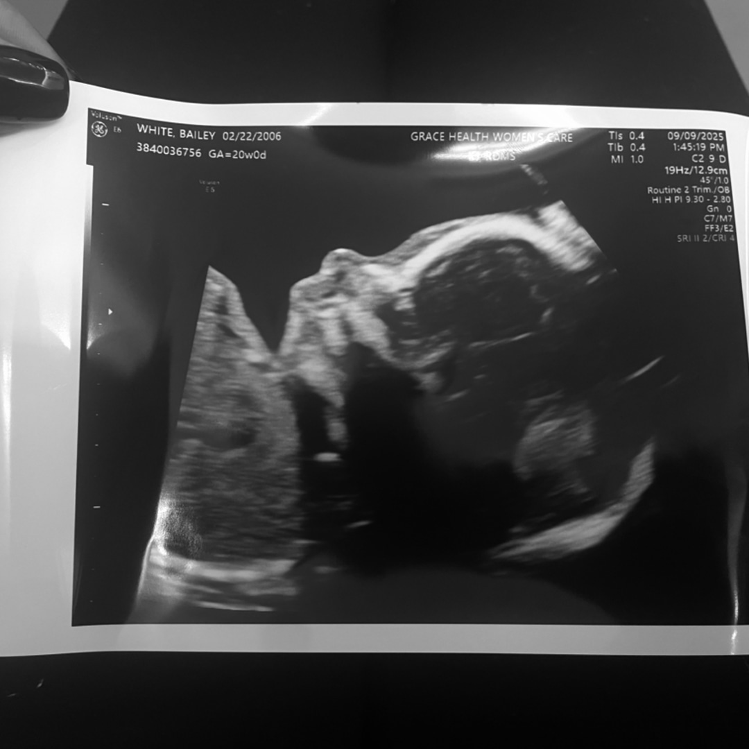 Photo shared by Bailey for their Babylist baby registry.