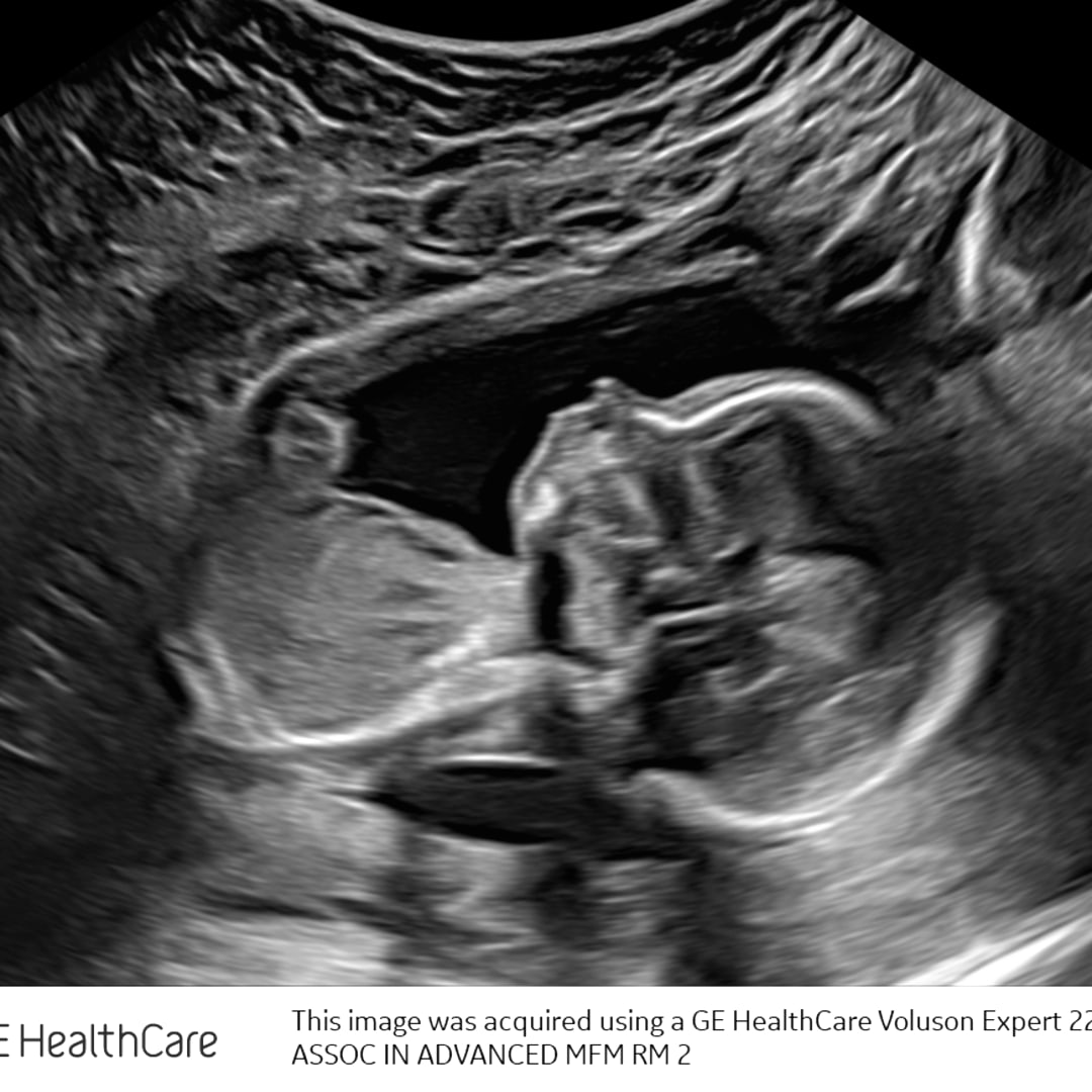 Photo shared by Arleen for their Babylist baby registry.