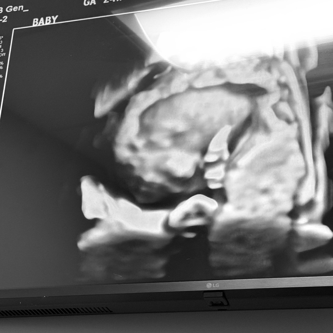 Photo shared by Jailene for their Babylist baby registry.