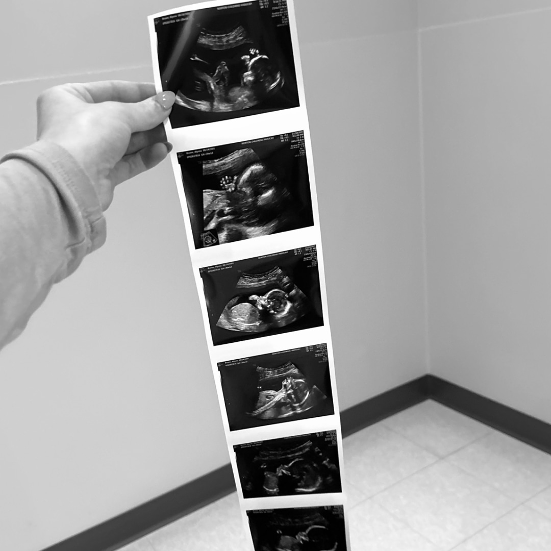 Photo shared by Alyssia for their Babylist baby registry.