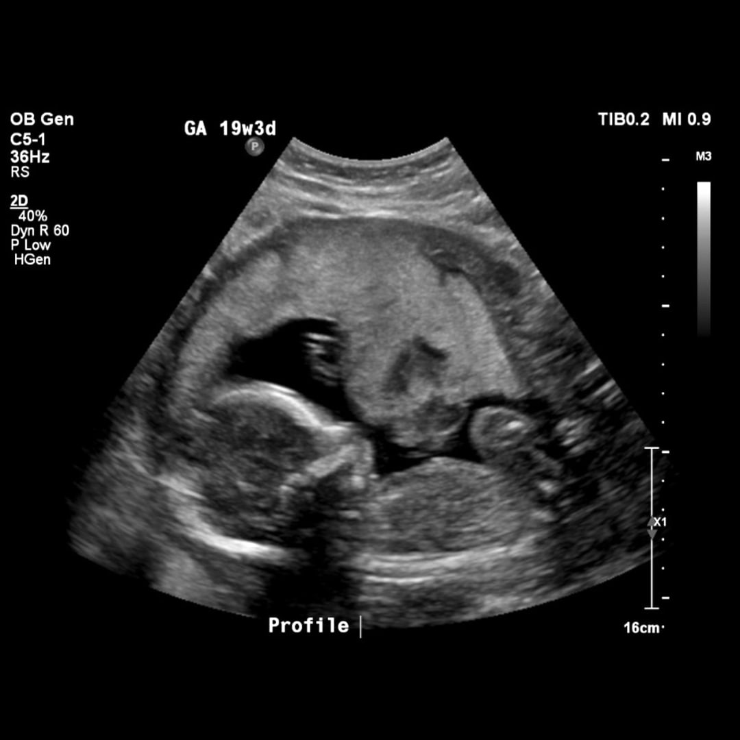 Photo shared by Arianna & Christian for their Babylist baby registry.