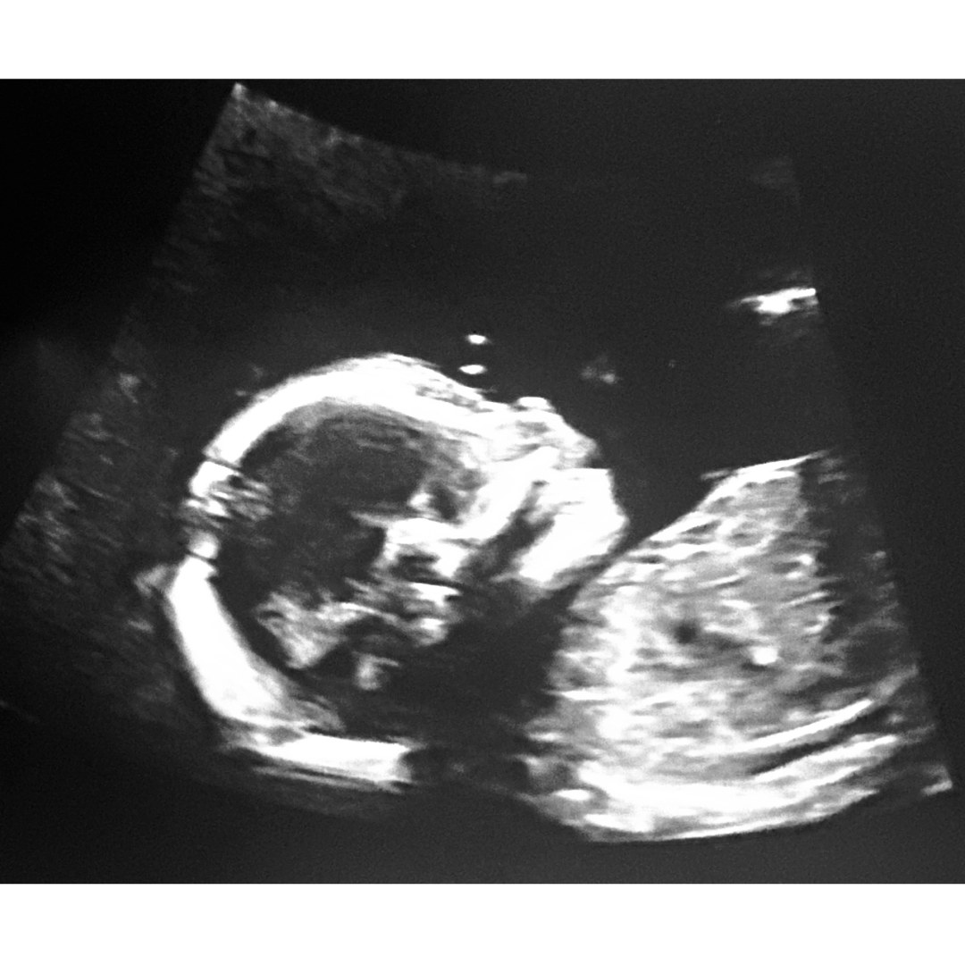Photo shared by Flor for their Babylist baby registry.