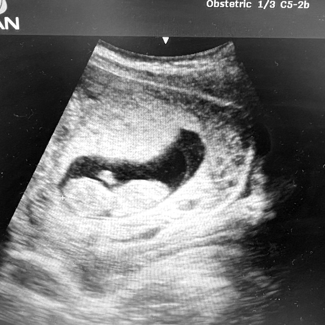 Photo shared by Samantha for their Babylist baby registry.