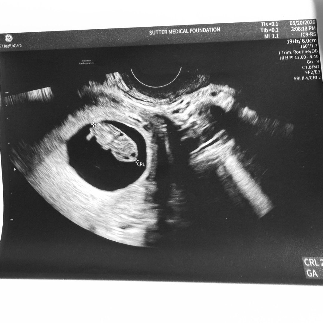 Photo shared by Aislinn for their Babylist baby registry.