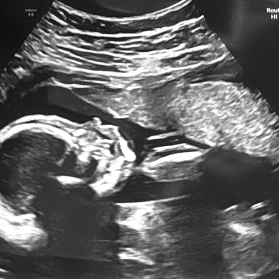 Photo shared by Isabelle for their Babylist baby registry.