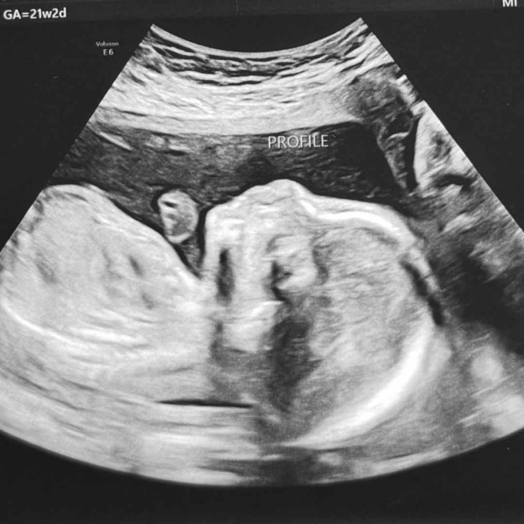 Photo shared by Payton for their Babylist baby registry.