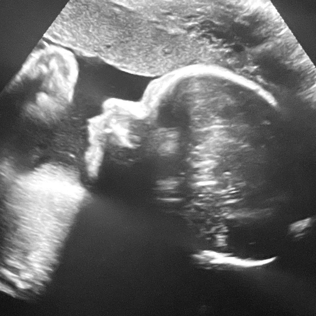 Photo shared by Jordyn for their Babylist baby registry.