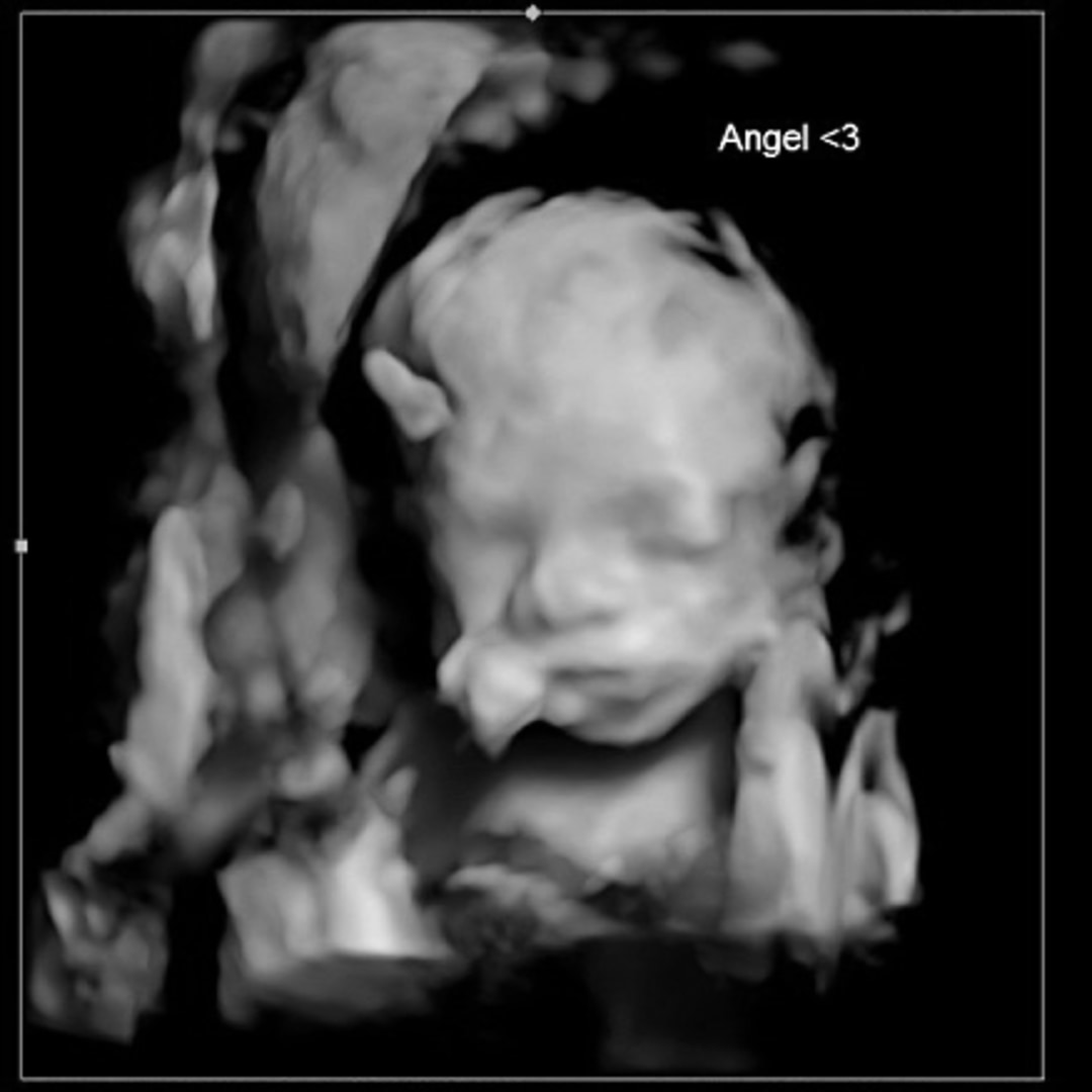 Photo shared by Mya for their Babylist baby registry.