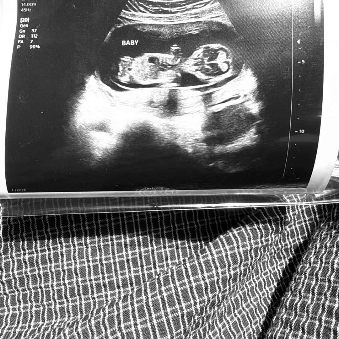 Photo shared by Jacky for their Babylist baby registry.