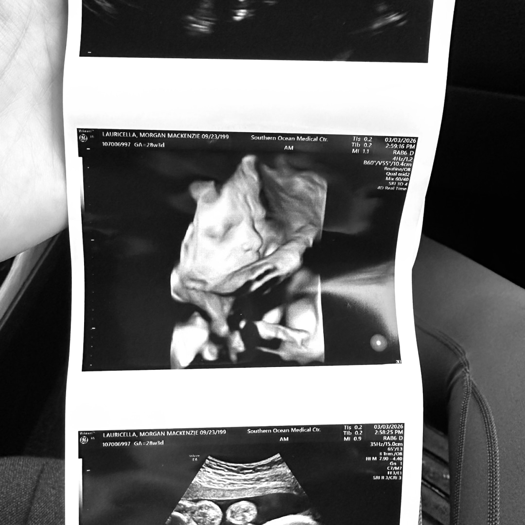 Photo shared by Morgan for their Babylist baby registry.