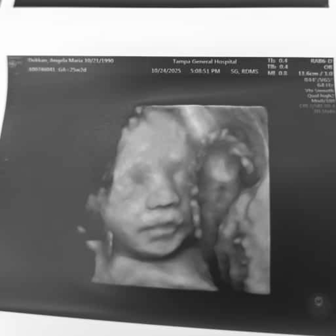 Photo shared by Angela for their Babylist baby registry.